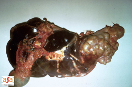 Tuberculome du foie d'un bovin source