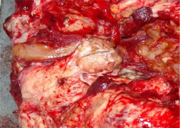 Lésions macroscopiques de tuberculose chez des bovins : différentes tailles